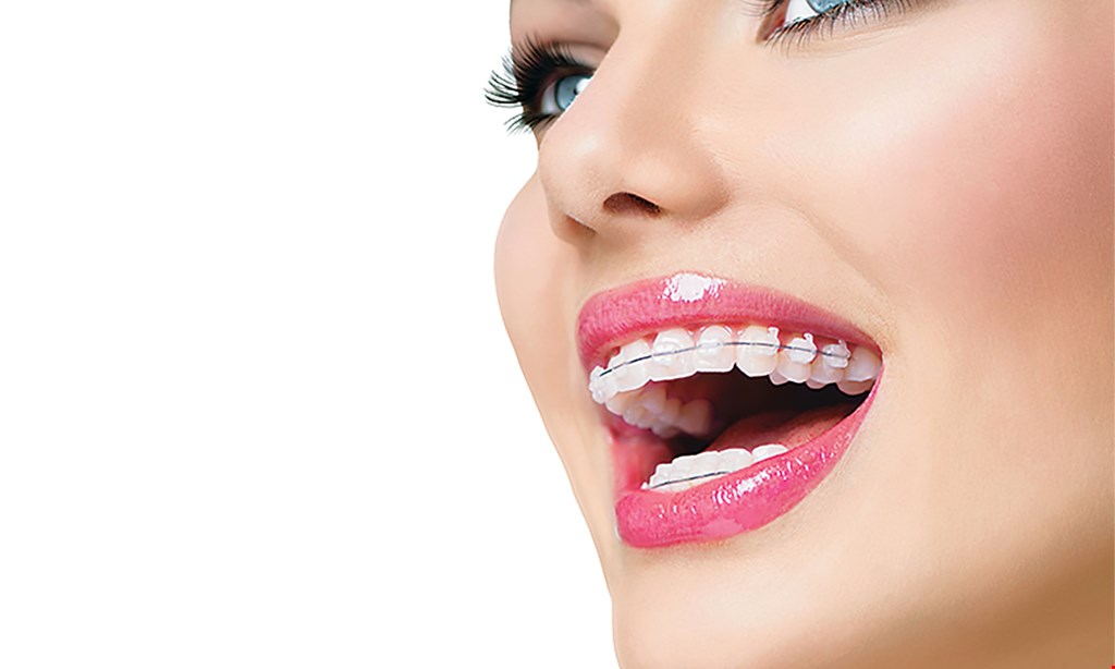 Product image for Prodent Group FREE Teeth Whitening