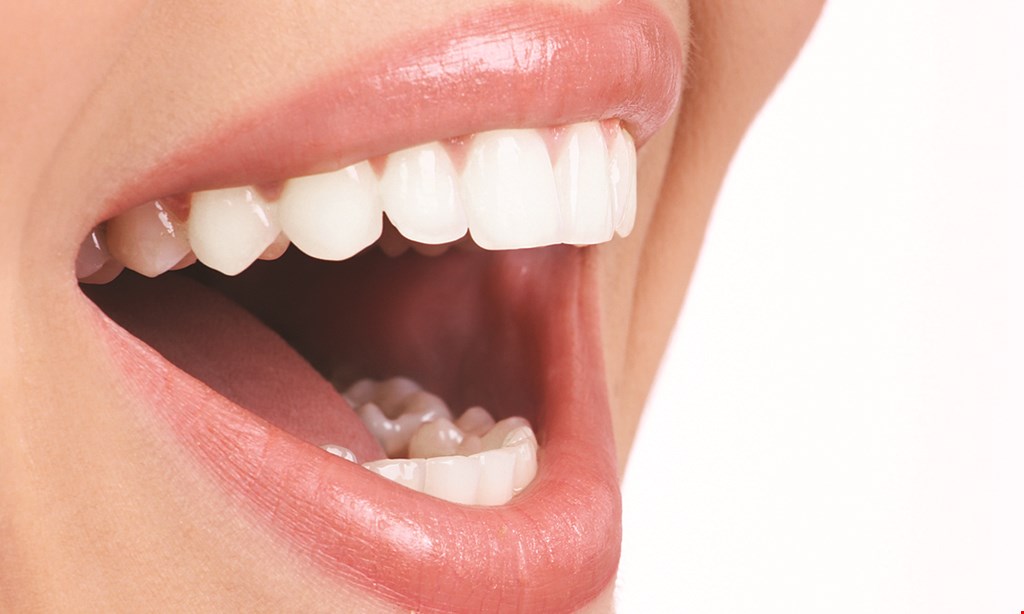 Product image for DIANA WOHLSTEIN DMD $1000 Off invisalign full 