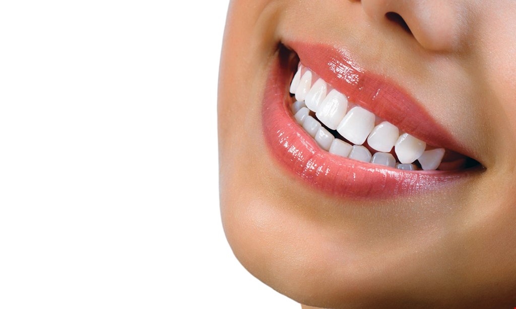 Product image for Gentle Family Dentistry & Dental Implants 30% off full mouth deep cleaning.
