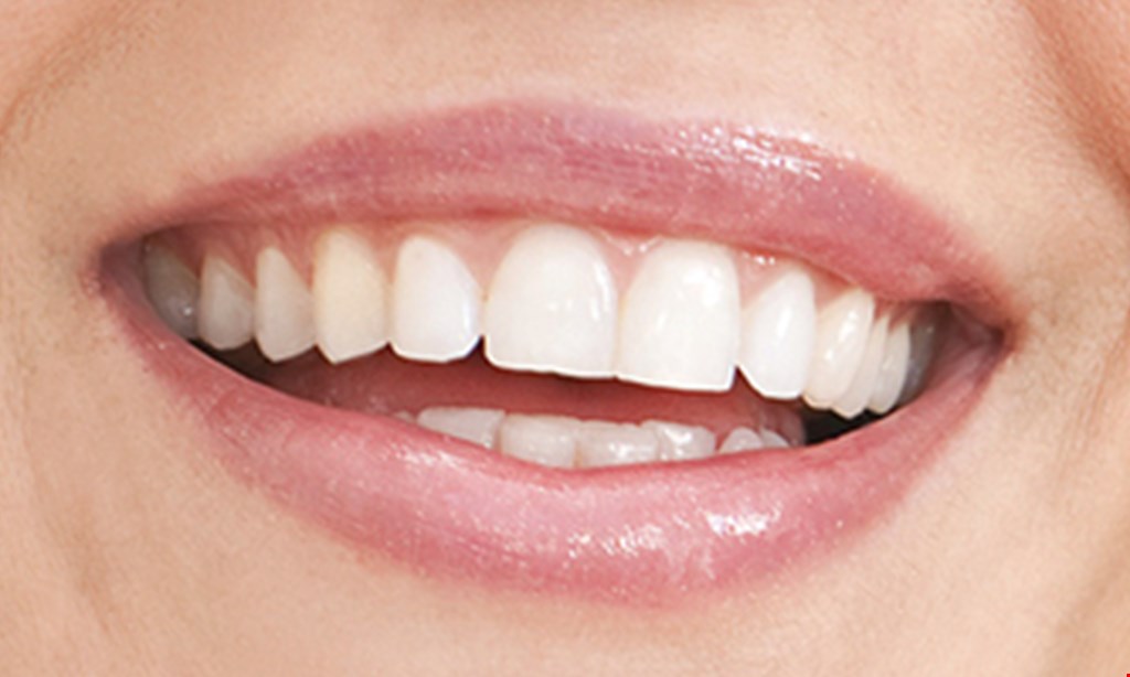 Product image for Seaview Dental $995 each implants 