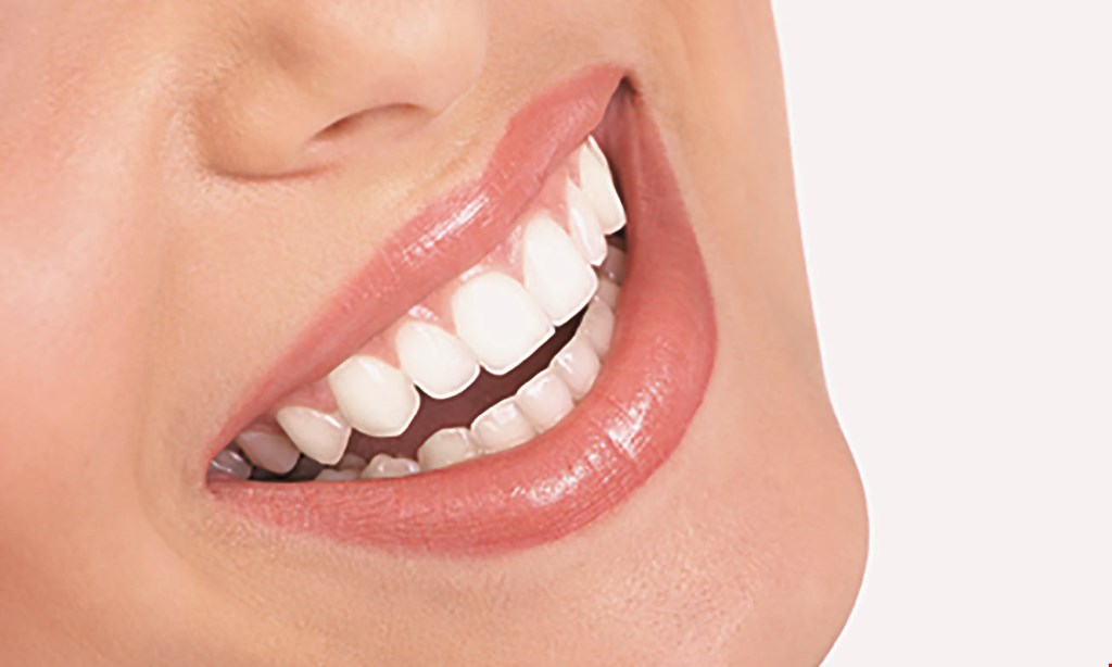 Product image for XO Dentistry $1895 Clear Braces Special