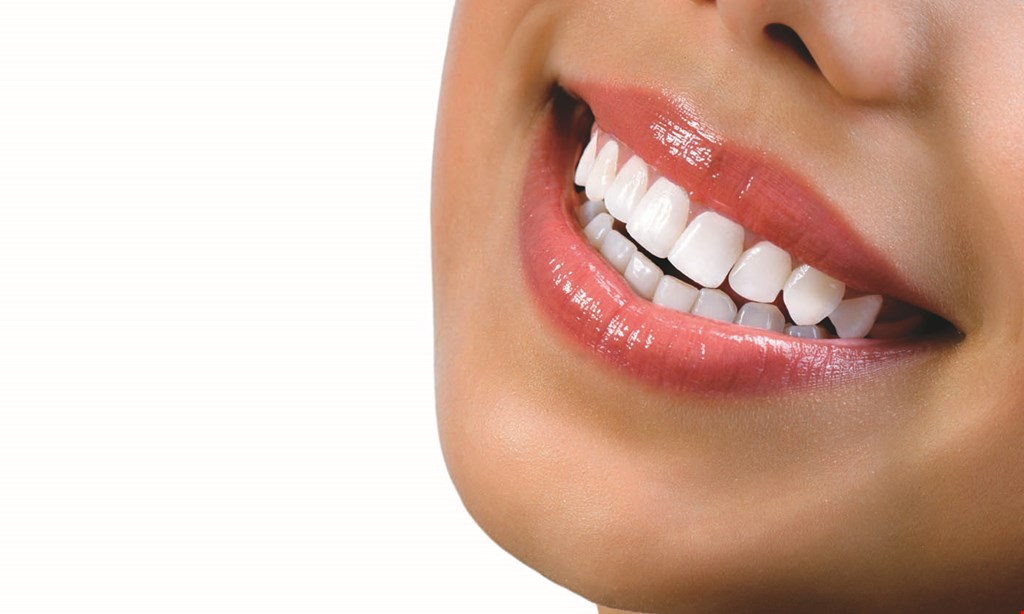 Product image for Gainesville Dental Arts $199 take-home custom whitening trays 