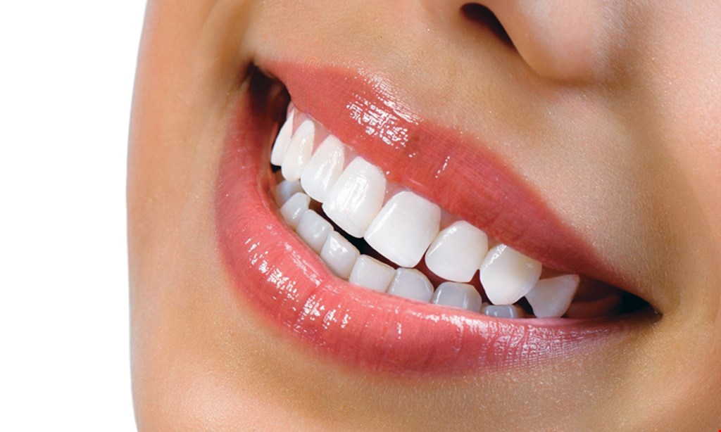 Product image for Creative Smiles Free professional whitening