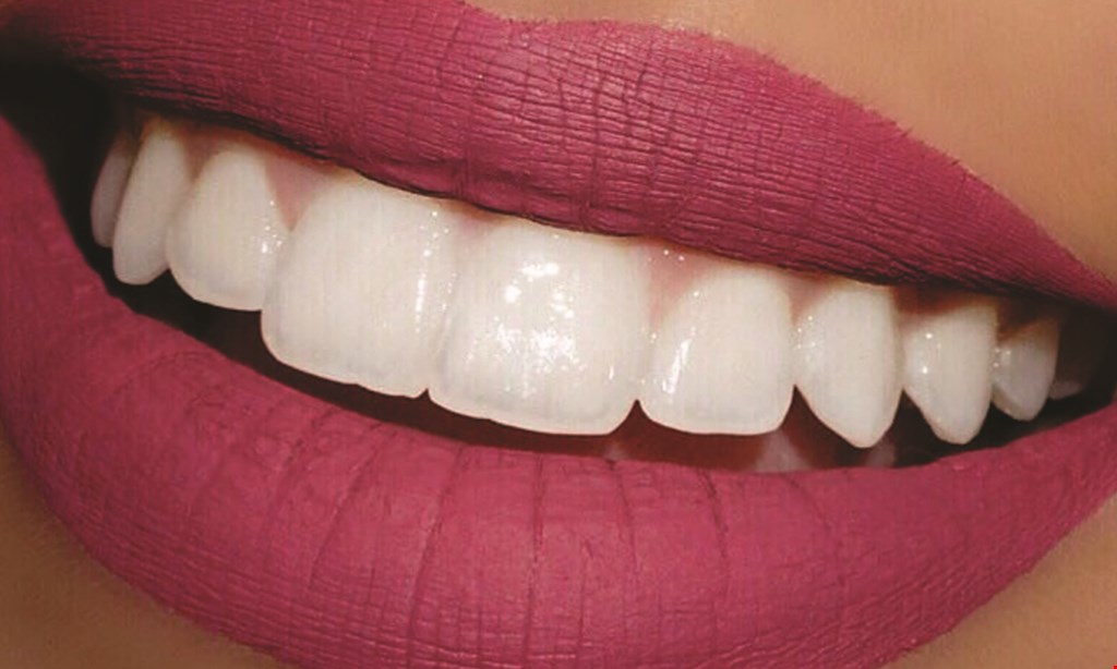 Product image for Smile Crafters 20% Off teeth whitening. 