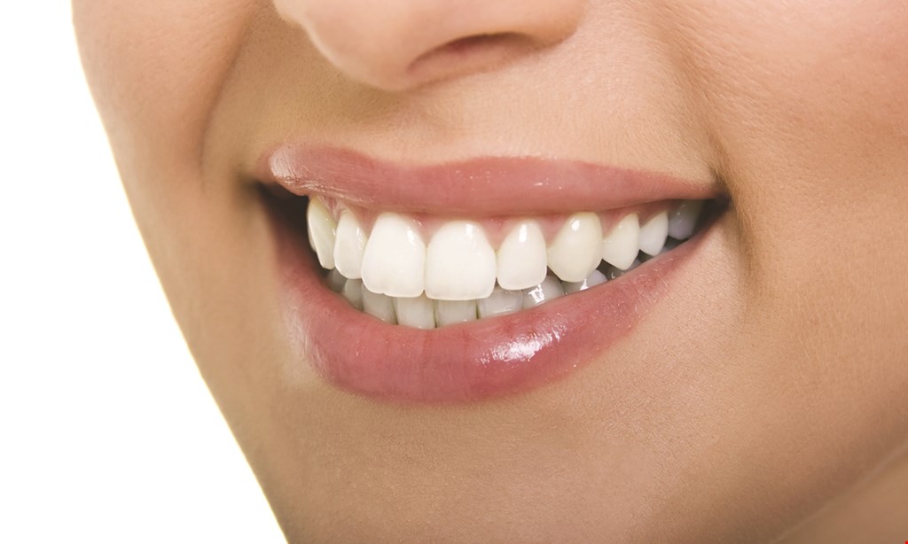 Product image for North Coast Dental $500 Off Invisalign. 