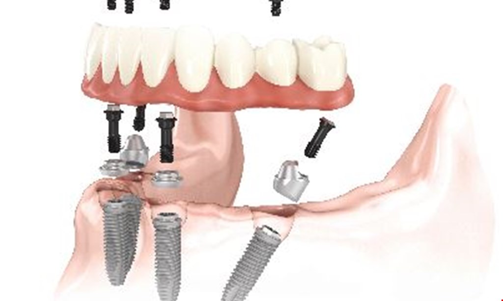 Product image for A+ Dental Free Second Opinion. Consultation Exam and X-Rays