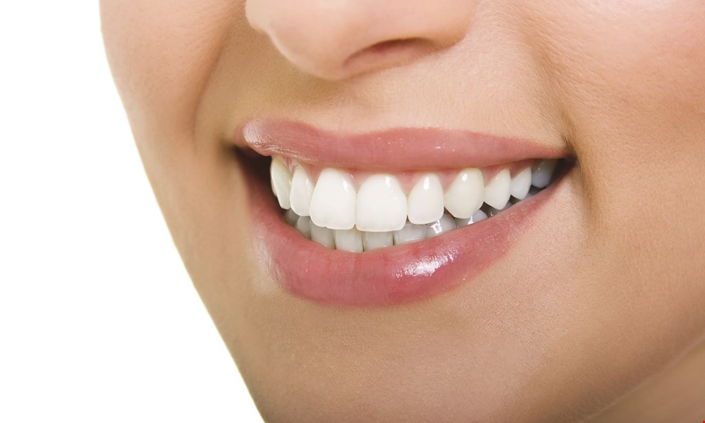 Product image for American Dental Free Teeth Whitening