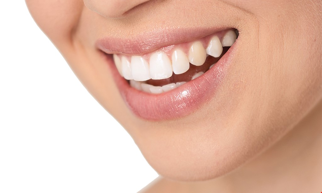 Product image for New Image Dental Group Free whitening for life. 