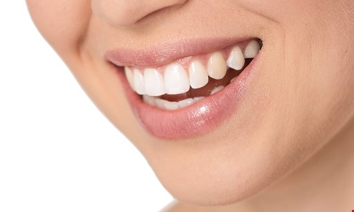 Product image for Mady Dental $79 New Patient Offer 