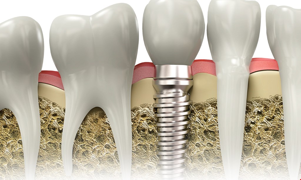 Product image for True Design Dentistry $135 New Patient Special