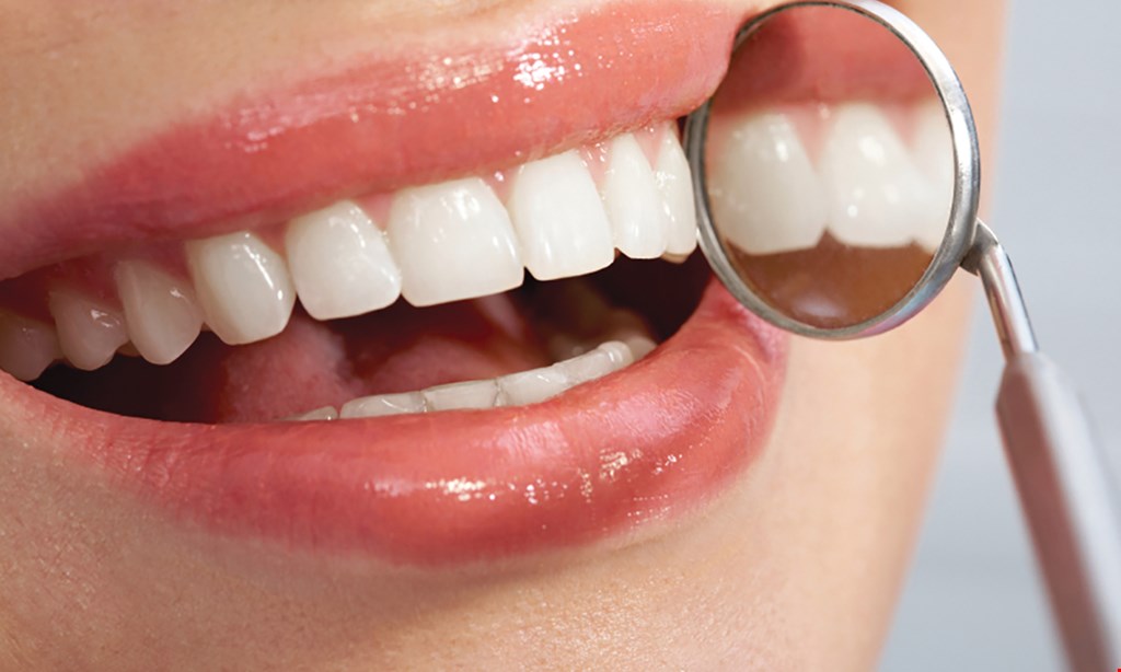 Product image for Overland Dental Practice Teeth whitening only $199 (1 hour in office).