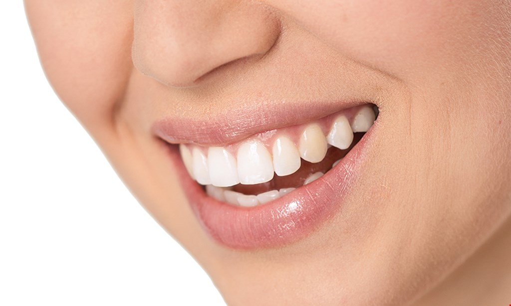 Product image for The Smile Group- Dr. Burden/West Point NEW PATIENTS SPECIAL!