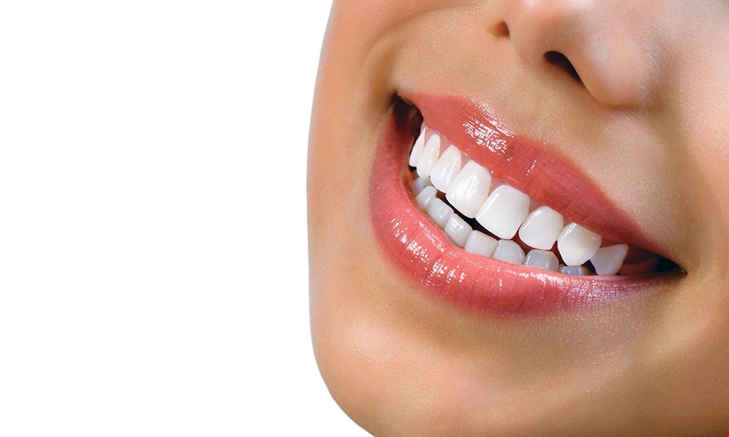 Product image for Ben Mandel, DDS $99 whitening trays per arch ($399 value).