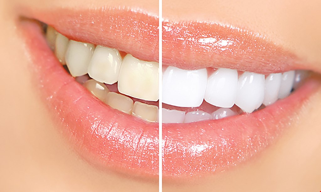 Product image for Spectrum Dental 20% off Spectrum Dental Savings Plan Ask us for details.