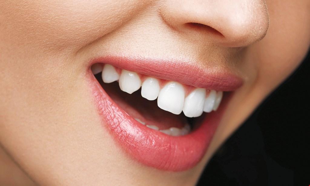 Product image for Diamond Dental $2499 Implant Special. 