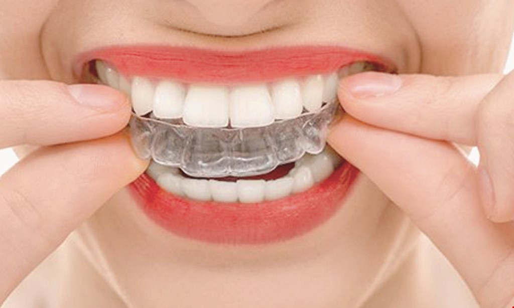 Product image for Dental Progress FREE ORTHODONTIC EVALUATION AND INVISALING