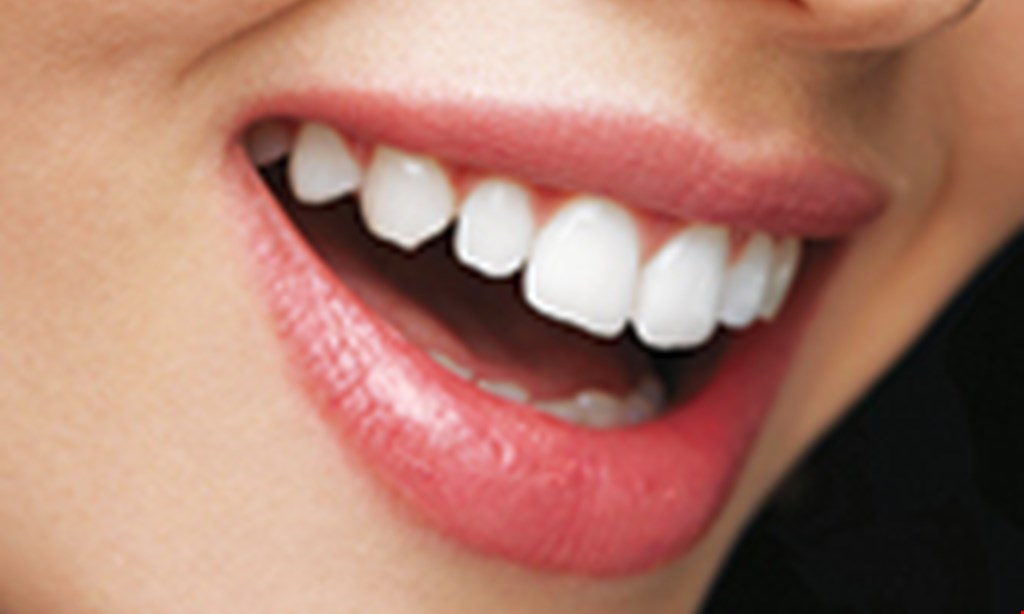Product image for Crestview Dental Free implant consult