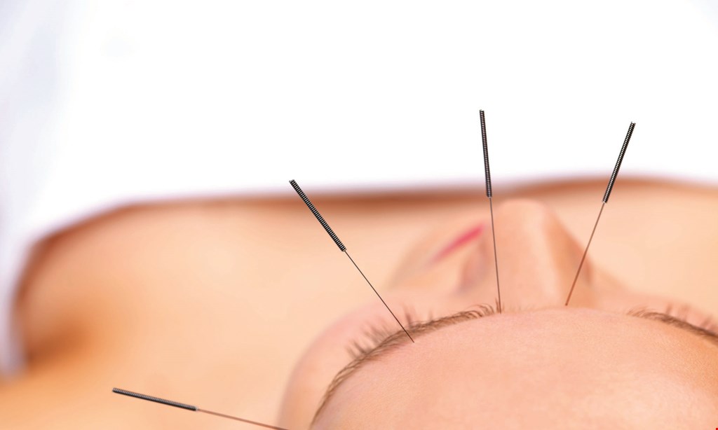 Product image for All The Way Health Acupuncture And Herb $25 OFF initial visit & exam. 