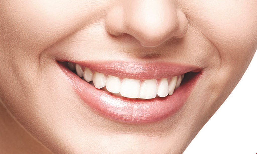 Product image for Moe's Teeth Whitening ONLY $110 TEETH WHITENING reg. $319.