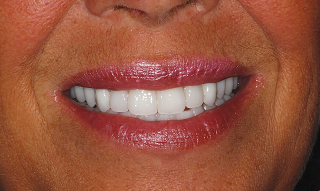 Product image for Canatella Dental $79 NEW PATIENT SPECIAL Cleaning, X-Rays and Comprehensive Exam.