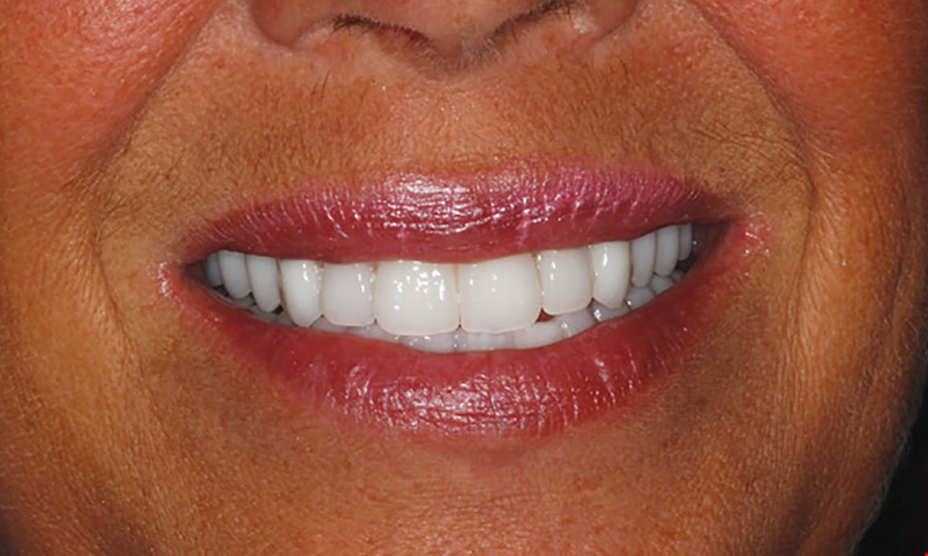 Product image for Canatella Dental $79 New Patient Special. Cleaning, X-Rays and Comprehensive Exam