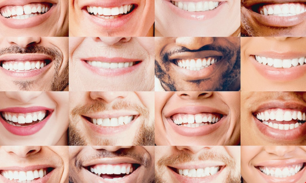 Product image for Smile Sky Dental $200discount for cosmetic veneers. 