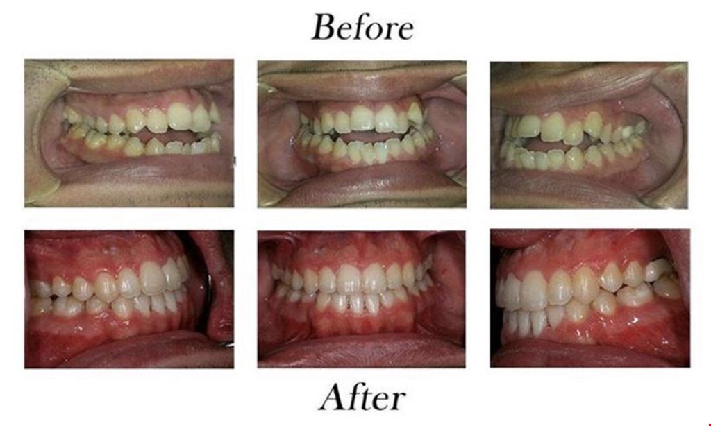 Product image for Encino Dental Studio $59 Exam, X-Rays, Cleaning andTeeth Whitening 