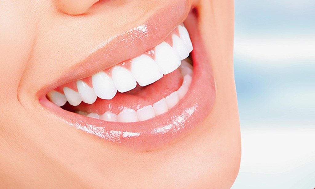 Product image for Smile Crafters $300 off invisalign.