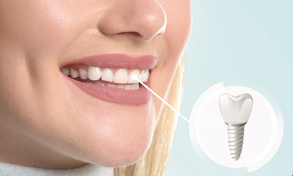 Product image for Sphinx Dental & Implant $99 New Patient Discount Exam, X-Ray & Cleaning 20% Off Restorative Procedures