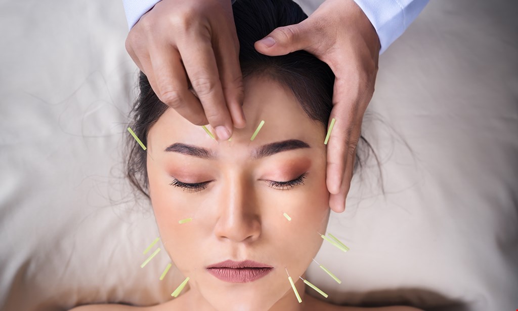 Product image for Yb Acupuncture Clinic $40 off one 5 acupuncture treatment package.