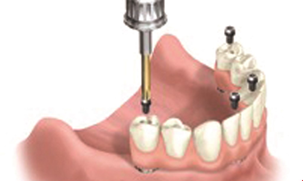 Product image for Guerrino Dentistry of Mt. Vernon $150 exam, prophylaxis, bite-wings & fluoride (Reg. $395)