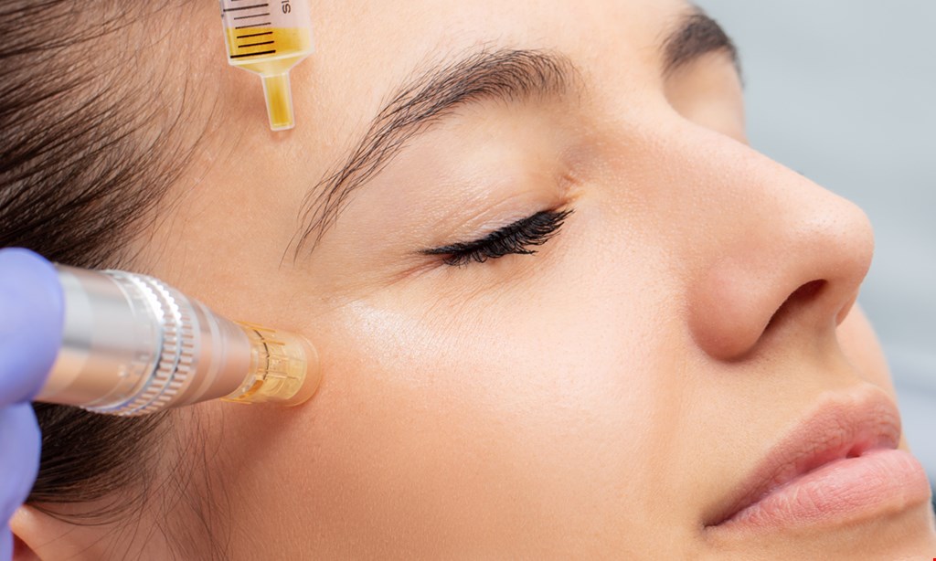 Product image for Porefecting Skin Solutions $158 for Microneedling - Face and neck included, and a Jessner peel ($318 value)