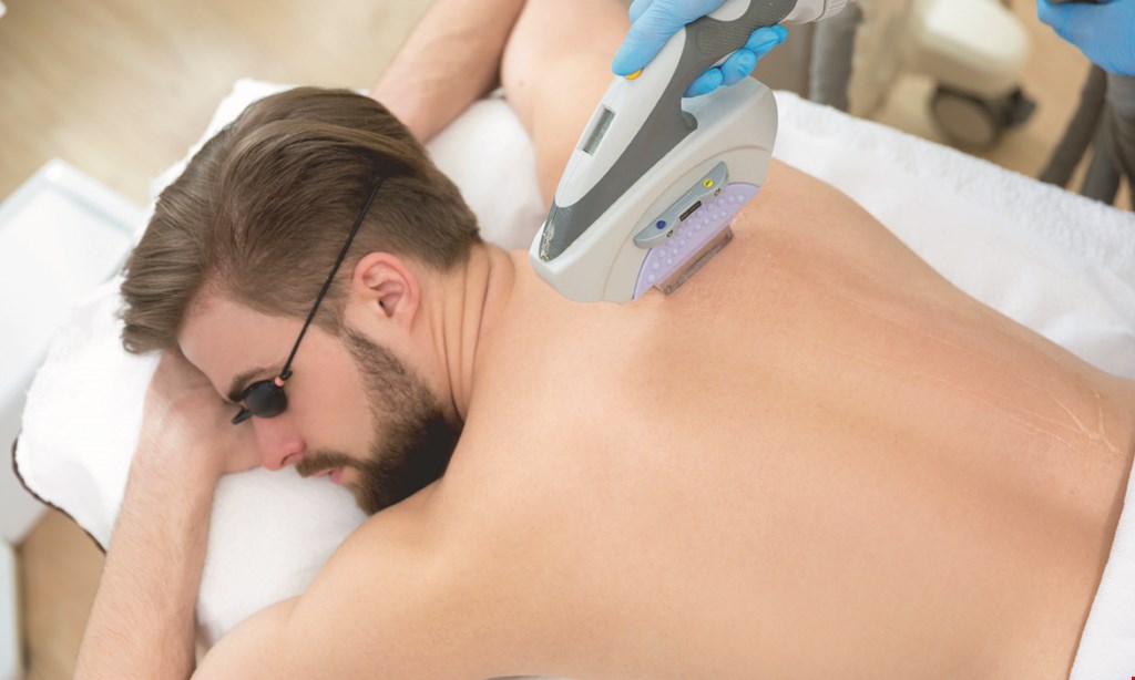 Product image for Moxi $45 for $90 Toward Laser Hair Removal