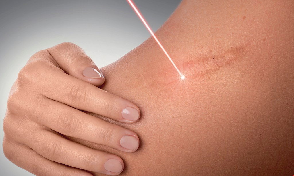 Product image for Shore Laser + Aesthetics $50 For $100 Toward Any Med Spa Service