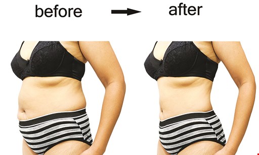 Product image for Youthful Medical Spa $499 For 1-Cycle Of FDA Cleared Coolsculpting Elite (Reg. $1000)